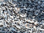 CD122/IL2RB Antibody in Immunohistochemistry (Paraffin) (IHC (P))