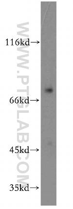CD122/IL2RB Antibody in Western Blot (WB)