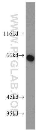 Carboxypeptidase A6 Antibody in Western Blot (WB)
