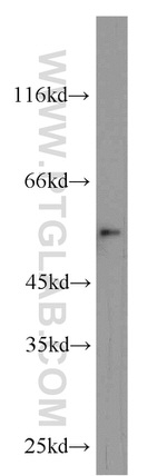 Carboxypeptidase A6 Antibody in Western Blot (WB)