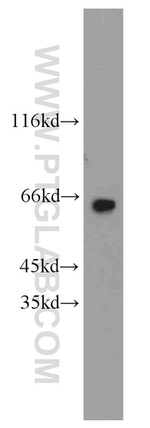 Carboxypeptidase A6 Antibody in Western Blot (WB)