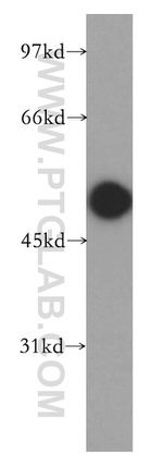 Carboxypeptidase A6 Antibody in Western Blot (WB)