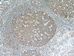 FBXO22 Antibody in Immunohistochemistry (Paraffin) (IHC (P))