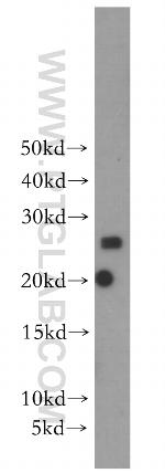 SCN2B Antibody in Western Blot (WB)