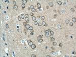 CAMK1D Antibody in Immunohistochemistry (Paraffin) (IHC (P))