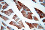 MLXIP Antibody in Immunohistochemistry (Paraffin) (IHC (P))