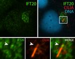 IFT20 Antibody in Immunocytochemistry (ICC/IF)