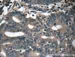 IFT20 Antibody in Immunohistochemistry (Paraffin) (IHC (P))