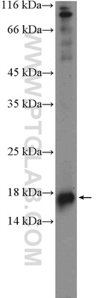 IFT20 Antibody in Western Blot (WB)