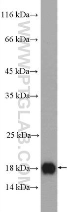 IFT20 Antibody in Western Blot (WB)