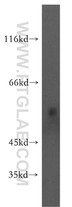 RASGEF1B Antibody in Western Blot (WB)