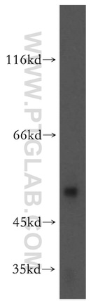 RASGEF1B Antibody in Western Blot (WB)