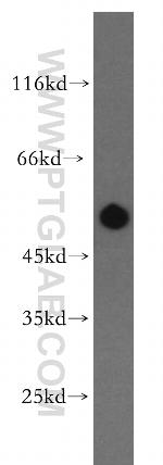 RASGEF1B Antibody in Western Blot (WB)