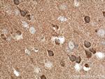 TTL Antibody in Immunohistochemistry (Paraffin) (IHC (P))