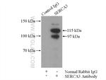SERCA3 Antibody in Immunoprecipitation (IP)