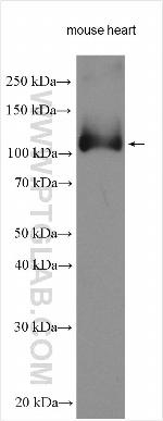 SERCA3 Antibody in Western Blot (WB)