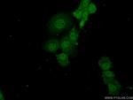 ADAT2 Antibody in Immunocytochemistry (ICC/IF)