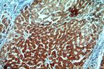 ADAT2 Antibody in Immunohistochemistry (Paraffin) (IHC (P))