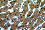 ADAT2 Antibody in Immunohistochemistry (Paraffin) (IHC (P))
