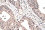 ADAT2 Antibody in Immunohistochemistry (Paraffin) (IHC (P))