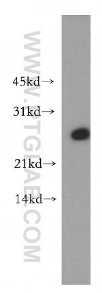 ADAT2 Antibody in Western Blot (WB)