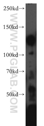 KCNH7 Antibody in Western Blot (WB)