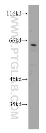 CAMKK1 Antibody in Western Blot (WB)