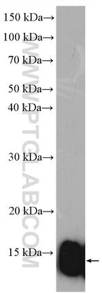 FABP1 Antibody in Western Blot (WB)