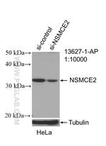 NSMCE2 Antibody in Western Blot (WB)
