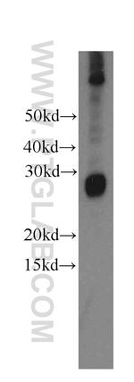 NSMCE2 Antibody in Western Blot (WB)