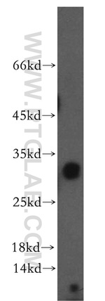 NSMCE2 Antibody in Western Blot (WB)