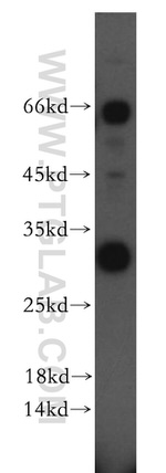 NSMCE2 Antibody in Western Blot (WB)