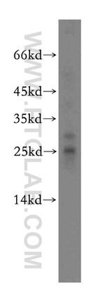 NSMCE2 Antibody in Western Blot (WB)