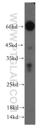 NSMCE2 Antibody in Western Blot (WB)