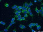 CREB3L4 Antibody in Immunocytochemistry (ICC/IF)