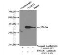 PNMA1 Antibody in Immunoprecipitation (IP)