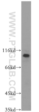 TROAP Antibody in Western Blot (WB)