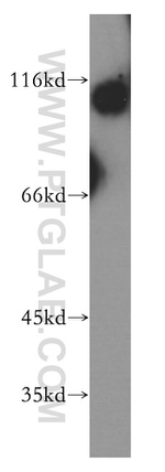TROAP Antibody in Western Blot (WB)