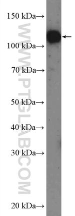 TROAP Antibody in Western Blot (WB)