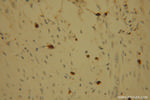 POLI Antibody in Immunohistochemistry (Paraffin) (IHC (P))