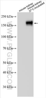NKCC2 Antibody in Western Blot (WB)