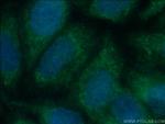 TULP3 Antibody in Immunocytochemistry (ICC/IF)