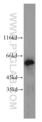 MAK Antibody in Western Blot (WB)