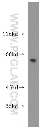MAK Antibody in Western Blot (WB)