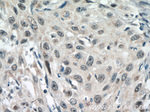 DSS1 Antibody in Immunohistochemistry (Paraffin) (IHC (P))