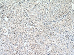 DSS1 Antibody in Immunohistochemistry (Paraffin) (IHC (P))
