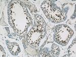 UIMC1 Antibody in Immunohistochemistry (Paraffin) (IHC (P))