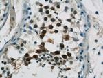 UIMC1 Antibody in Immunohistochemistry (Paraffin) (IHC (P))