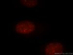 UIMC1 Antibody in Immunocytochemistry (ICC/IF)