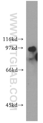 UIMC1 Antibody in Western Blot (WB)